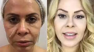 Acesse e veja mais informações, além de fazer o joelma antes da escuridão. Cenapop Joelma Surpreende Ao Mostrar Antes E Depois De Harmonizacao Facial