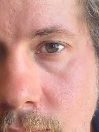 Are dark eyes with colorful flecks hazel?