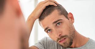 And not to mention that some of your hairstyles can be drying too: Dry Hair In Men Causes Treatment And Prevention
