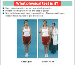 Image result for Cerebellar Function Test