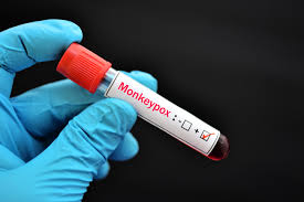 US stumbles in monkeypox response | WRBL