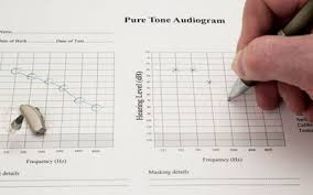 The Speech Banana In An Audiogram