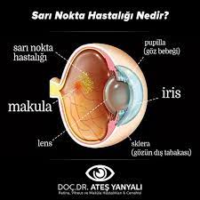 Yellow Dot Sari Nokta Doc Dr Ates Yanyali Nokta