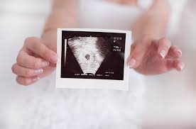 Dating scans are much less reliable how 13 weeks because at this stage babies often start growing at different rates. 8 Week Ultrasound Pregnancy Issues Huggies