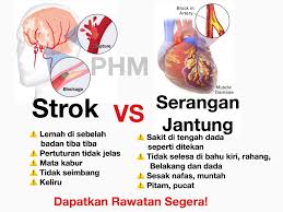 Penyebab sakit dada sebelah kiri terkait dengan organ jantung. Public Health Malaysia Strok Dan Serangan Jantung Adalah Punca Kematian Utama Di Malaysia Jika Seseorang Individu Mengalami Serangan Jantung Atau Stroke Setiap Minit Adalah Sangat Berharga Semakin Lambat Semakin Banyak Sel