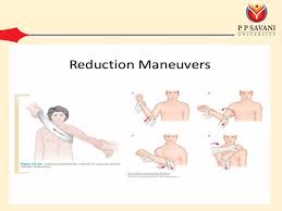 Image result for Shoulder Relocation Maneuvers