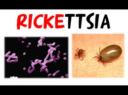 Image result for Rickettsiae