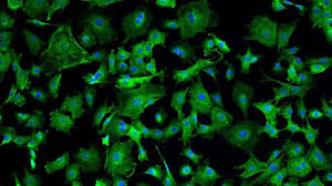 Understand the risks of inflammation. Patients Improve After Heart Cell Therapy Eurekalert Science News
