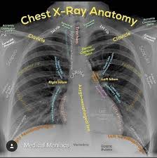 Pin By Ajb On Degree Radiology Medical Anatomy Radiology Student