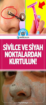 Sivilce Ve Siyah Noktalardan Kurtulun Cilt Bakimi Cilt Bakimi Siyah Noktalar Yuz Maskeleri