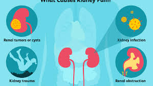 Most kidney or flank pain is felt around the location of the kidneys. Kidney Pain Causes Treatment And When To See A Doctor