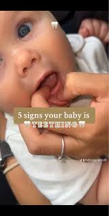 Zähne Schieben Baby