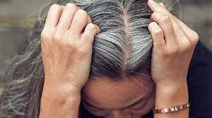 Taking large amounts of vitamin a or selenium is also toxic and can cause hair loss. 7 Things Your Hair Reveals About Your Health Everyday Health