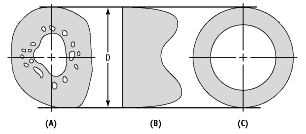 Vector illustration scheme of bone cross section. Femoral Geometry And Structure