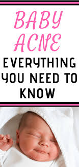 Learn how to prevent eczema. What Causes Baby Acne Simple Ways To Help It Clear Up