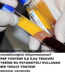 Prp Tedavisi Nedir Nasil Olur Bilgi Recete Dogal Receteler
