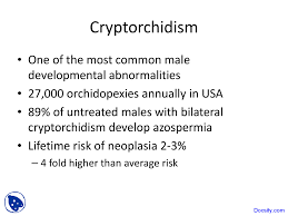 Cryptorchidism is the absence of one or both testes from the scrotum, with the missing testes in the inguinal canal. Cryptorchidism Pediatrics Lecture Slides Docsity