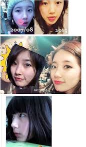 That same year, suzy also . Netizens Discuss Alleged Proof That Suzy Went Through Plastic Surgery Koreaboo
