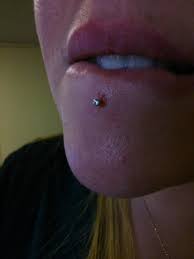 4 Years Old Lip Piercing Swollen Or It Kinda Hurts What To Do Piercing