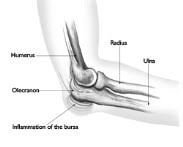 The bony projection of the ulna behind the elbow joint | meaning, pronunciation, translations and examples. Olecranon Bursitis Orthopaedic Neurosurgery Specialists