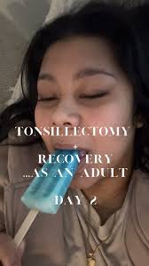 How do y’all even make it do day 5.. Omg. DAY 2. , #Lifestyle #tonsils  #tonsillectomy #tonsillectomyrecovery #relateable #reels #surgeryrecovery  #fyp #tonsillectomysurgery #fyp #explore ...