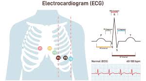 Image result for Electrocardiogram