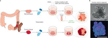 Check spelling or type a new query. Somatic Cell Derived Organoids As Prototypes Of Human Epithelial Tissues And Diseases Nature Materials