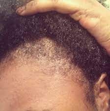 Hair breakage is usually a result of chemical treatments and too much heat. How To Stop Natural Hair From Breakage And Shedding 4c Haircare Com