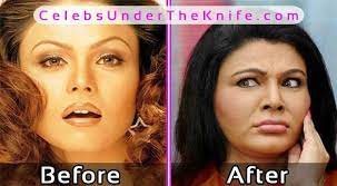 Rakhi sawant exposed like never before. Rakhi Sawant Before After Plastic Surgery Celebsundertheknife Celebs Celebrity Plast Bad Celebrity Plastic Surgery Celebrity Surgery Plastic Surgery Photos