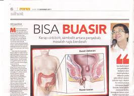 Mengobati buang air besar berdarah. Petua Dulu Dulu Posts Facebook