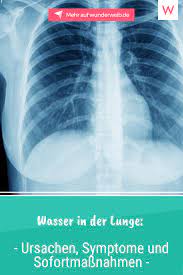 Wasser In Der Lunge Ursachen Und Symptome Wunderweib Lunge Lungenodem Fitness Tipps
