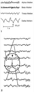 Ich habe mich mit auf hypnose , blockadenlösung und reiki spezialisiert. Elektroencephalogramm Lexikon Der Biologie