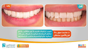 ابتسامة النجوم Starssmiledc Twitter