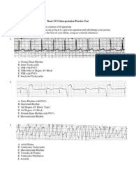 Pin On Ecg