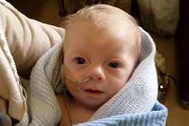 Father had to drive to North to get tubes for sick baby due to HSE medical  card delay