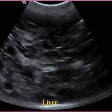 Discomfort in the upper abdomen on the right side. Pdf Ultrasonographic Diagnosis Of Liver And Gallbladder Surgical Affections In Dogs And Cats