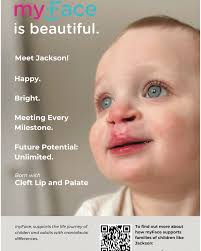 July is National #CraniofacialAwarenessMonth and we are so excited to share  with you all the #myFaceisBeautiful campaign! myFace believes the world is  stronger when every person is valued, respected, included, and empowered