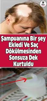 Sampuanina Bir Sey Ekledi Ve Sac Dokulmesinden Sonsuza Dek Kurtuldu Onemli Yaglar Bugunlerde Oldukca Tipik Hale Geldi Bireyler Son Sac Sac Dokulmesi Sampuan