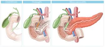 Check spelling or type a new query. Cholelithiasis Knowledge Amboss