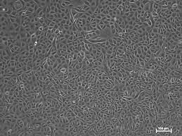 The vero cell line is continuous and aneuploid. Vero Cells Nutrivero Flex 10 Cell Line Type Vero Cells Species African Green Monkey Animal Free Yes Product Nutrivero Flex 10 Nutrivero Flex 10 Is A Chemically Defined Serum Free And Animal Component Free Medium Does Not Contain Plant Extract
