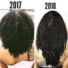 Hair Growth Secrets Using Natural Remedies For Longer Hair Hair Growth Secrets Natural Hair Growth Tips Hair Growth Progress