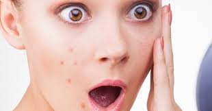 Bagaimana saya menghilangkan bintik pigmen secara lengkap. Tutorial Menghilangkan Jerawat Di Photoshop Sukainnet