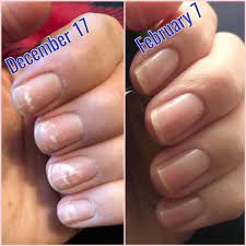 Gel Nail Damage Vs Color Street Color Street Color Street Nails Damaged Nails