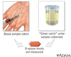Hình ảnh về Xylose test for intestinal absorption