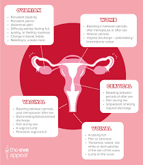 They are usually caused by the effect of a cancer on the part of the body where it is growing, although the disease can cause more general symptoms such as weight loss or tiredness. Gynae Cancers Video A Brief Explanation Eve Appeal