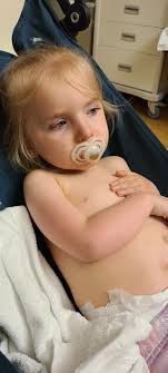 Cast with a removable arm cast sticker for comfort