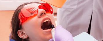 Polymerisation von Kompositen