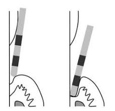 Periodontal Chart Department Of Periodontology School Of