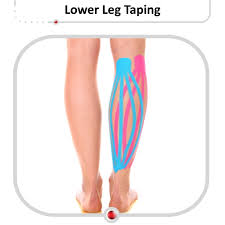 Image result for Taping for Soleus and Achilles