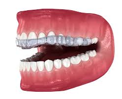 Image result for Occlusal